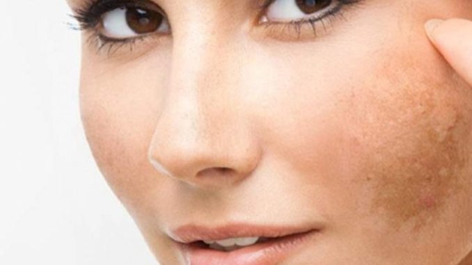 حبوب منع الحمل