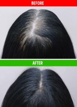 يقلل من فراغات الشعر وسقوطه