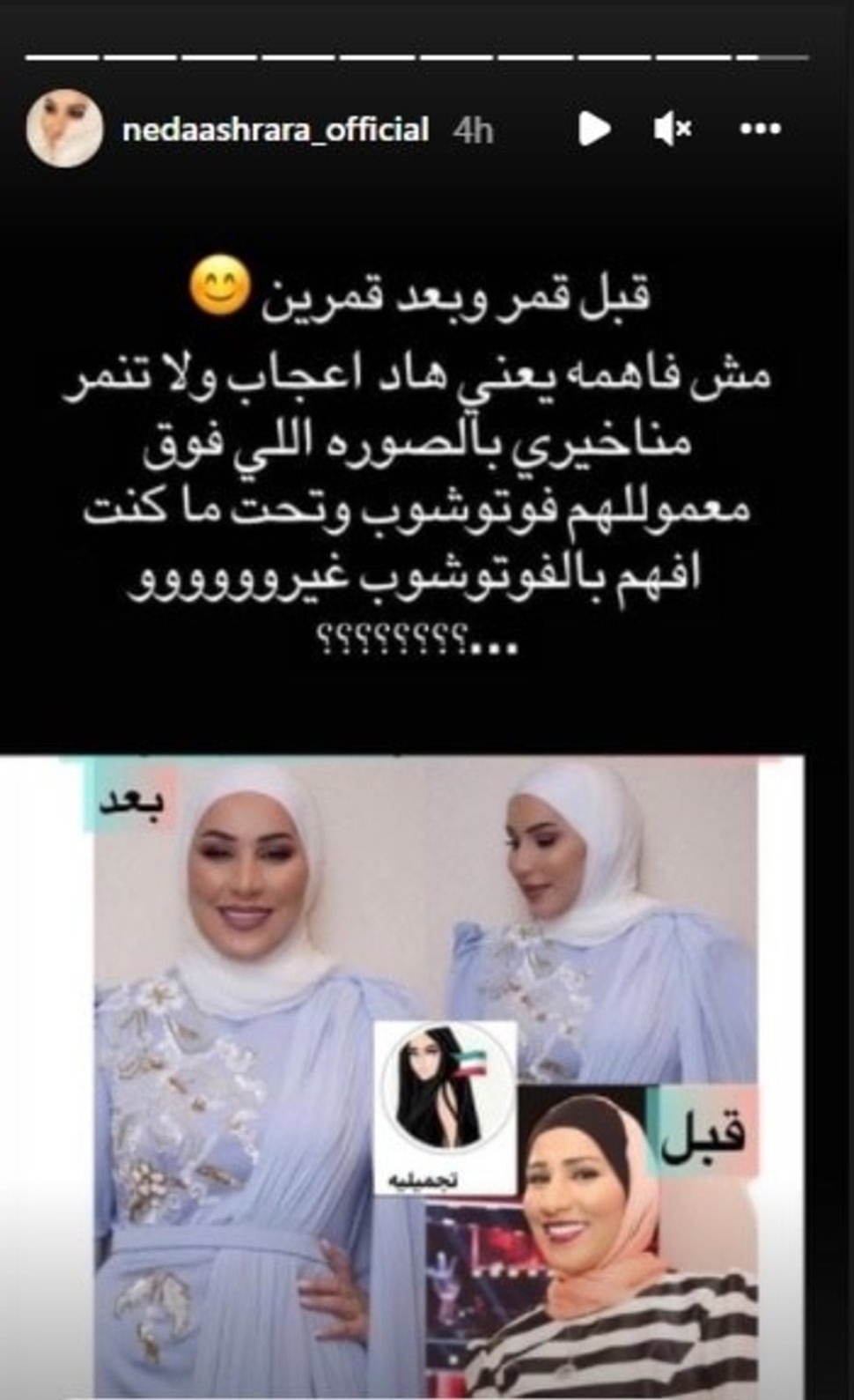 نداء شرارة تنفي خضوعها لعمليات تجميل