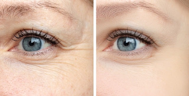 فوائد الزبيب