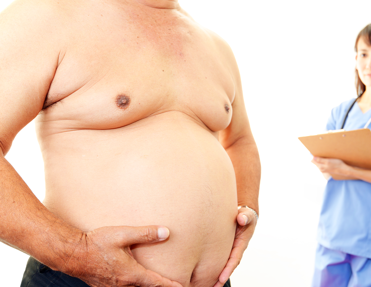 التثدي عند الرجال