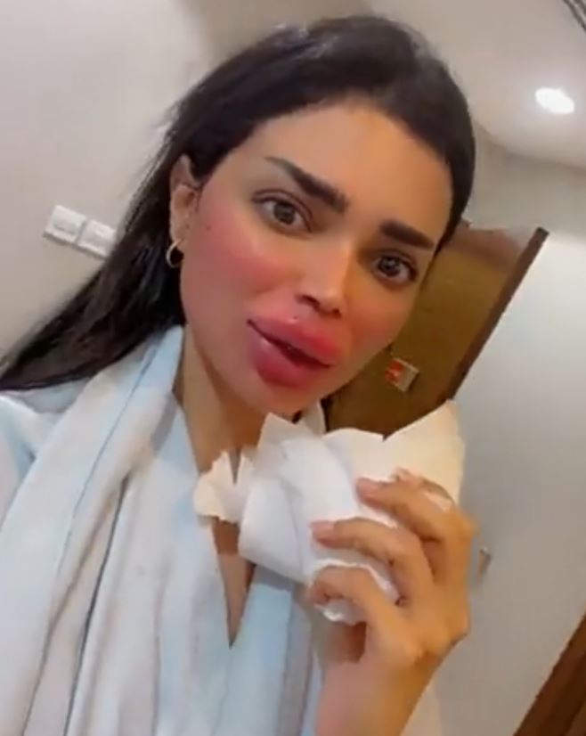 أودي الزبن