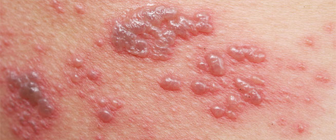  الحزام الناري