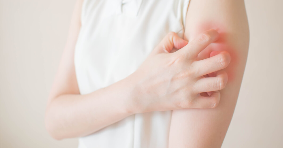 امراض جلدية تصيبك بالصيف وكيف عليك حماية بشرتك