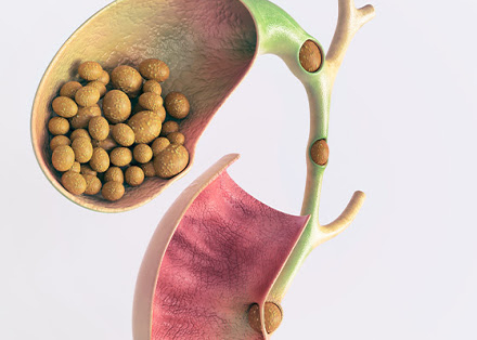 فوائد الزبيب