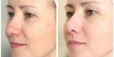 ما هي أفضل 7 أطعمة ومشروبات مضادة للشيخوخة؟