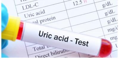 9 طرق لتقليل حمض اليوريك بشكل طبيعي في الجسم
