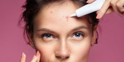 كيف تُخفي أي نوع من أنواع البثور؟