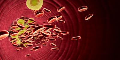 7 علاجات طبيعية لارتفاع نسبة الكوليسترول في الدم