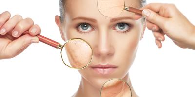 6  علاجات تجميلية مجربة لمكافحة التجاعيد!