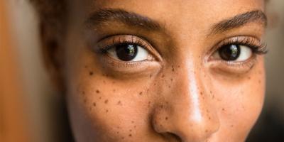 مشاكل شائعة في البشرة تظهر أثناء الحمل 