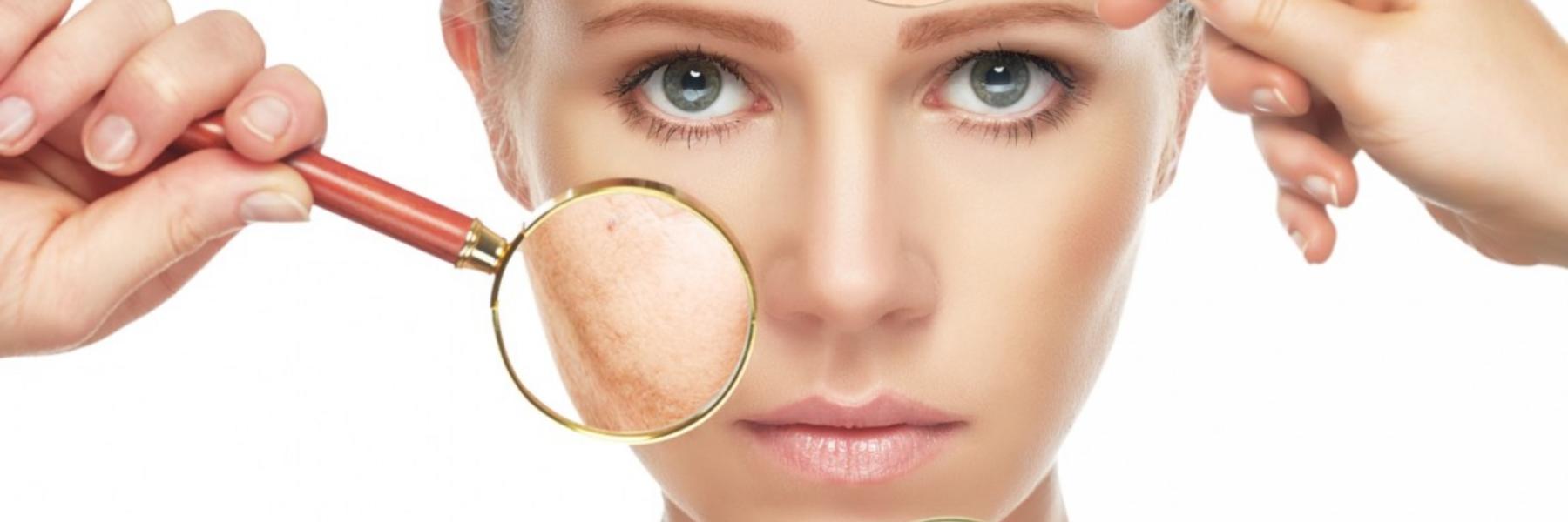 البشرة الجافة