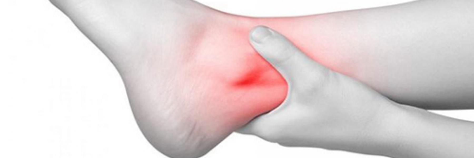 البروز العظمي للقدم