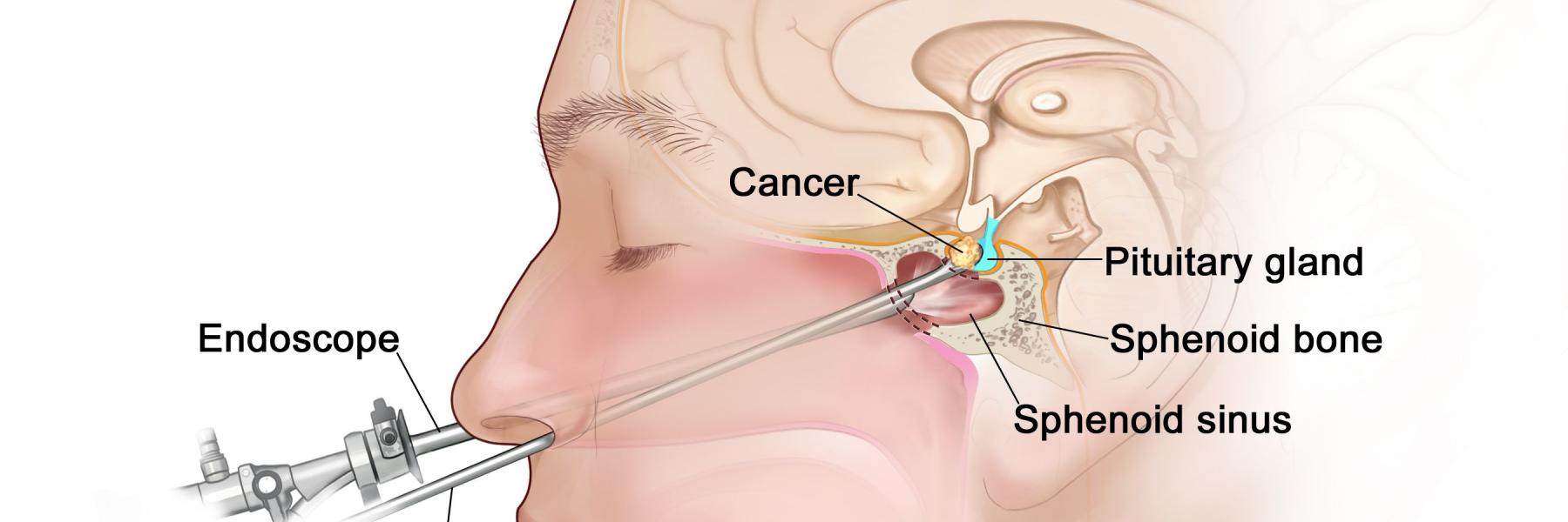 الغدة النخامية 