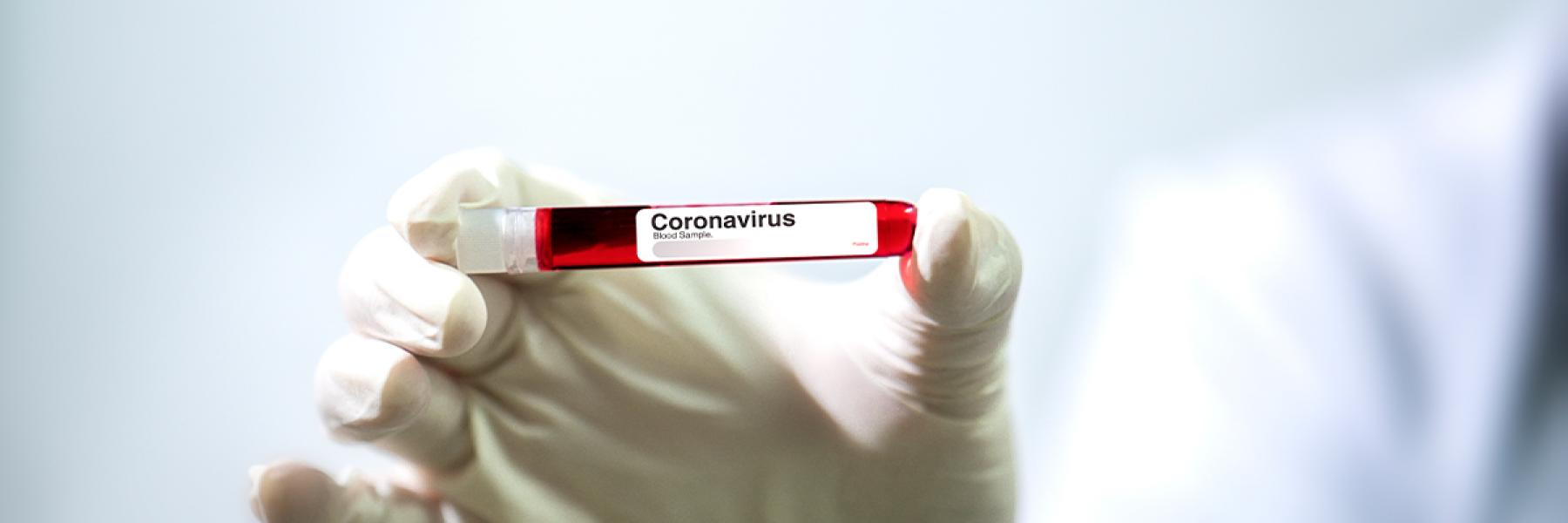 أطعمة تساعد على التعافي من كورونا