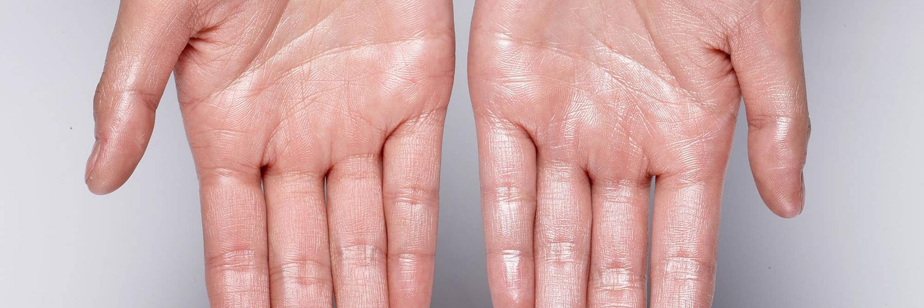 ما الذي يمكن أن يجعلك تتعرقين بسهولة؟ 