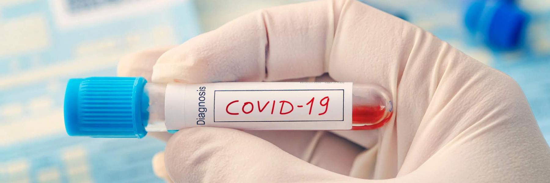 خاتم ذكي يكشف لمرتديه إذا ما كان مصابًا بفيروس كورونا!