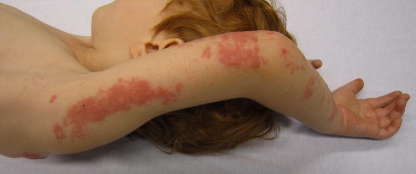 الحزام الناري