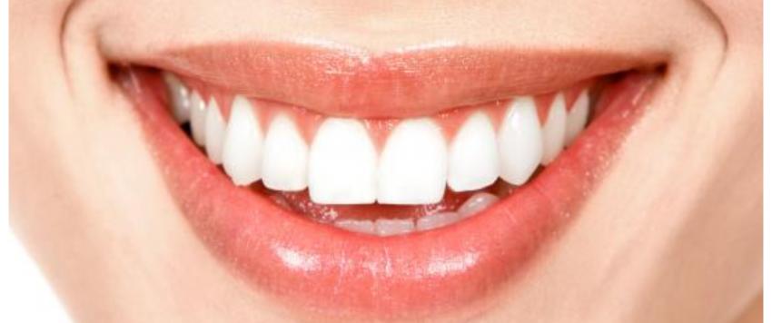 تبييض الاسنان