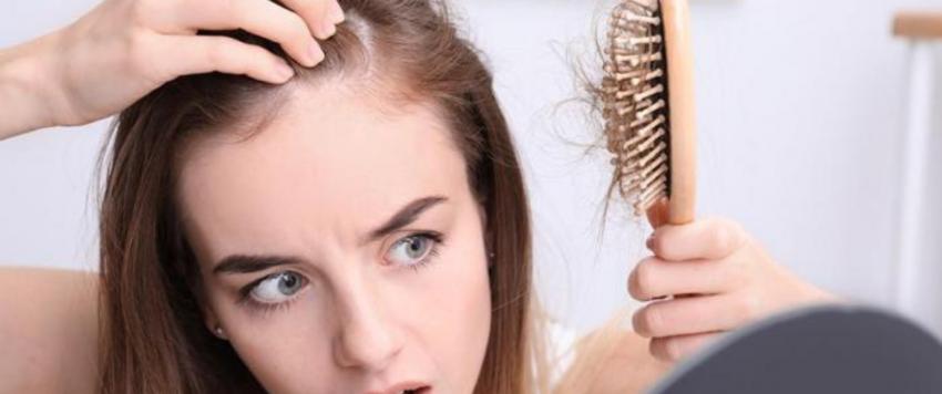 تساقط الشعر