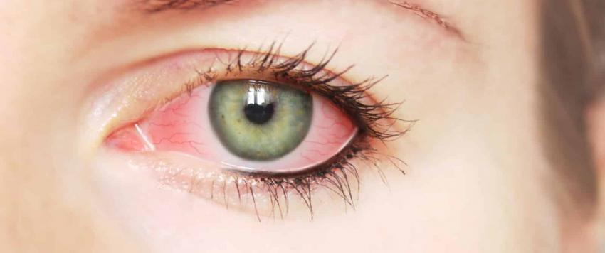 العلماء يطورون علاجًا جينيًا جديدًا لأمراض العين التى تؤدى لفقدان البصر