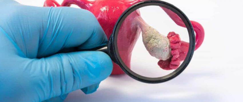 رجيم تكيس المبايض