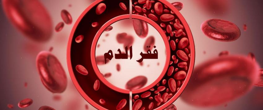 فقر الدم