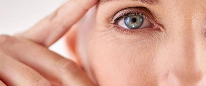 تجاعيد العين