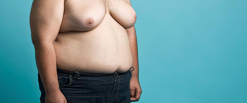 التثدي عند الرجال