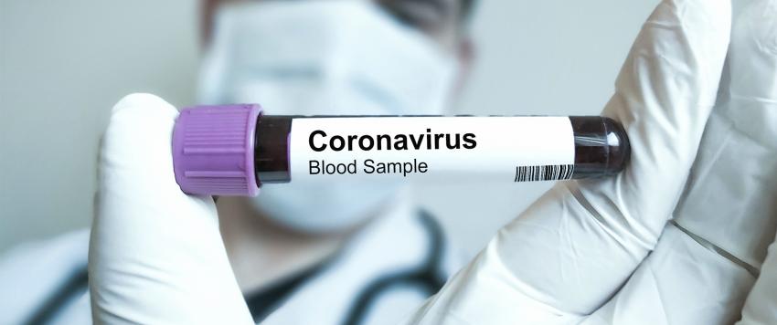 مرض الكورونا