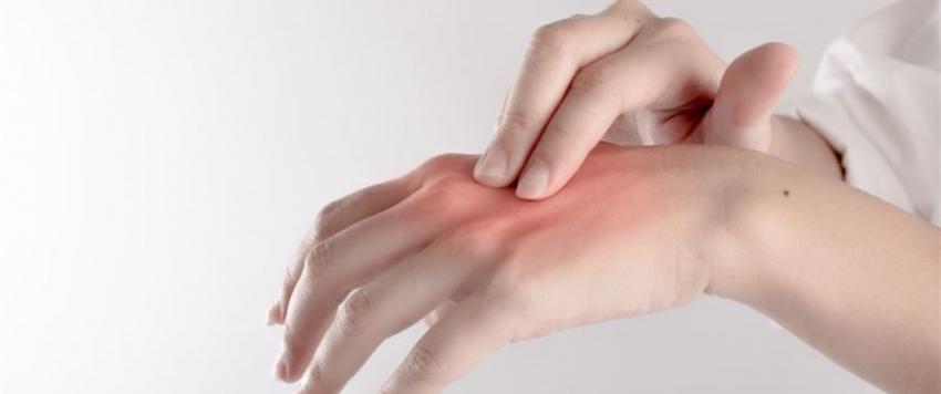 تورم الأصابع