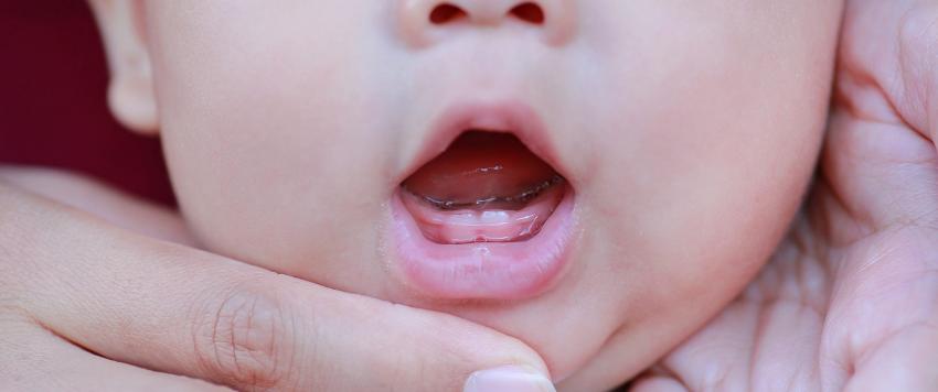 5 علاجات طبيعية من المنزل لتخفيف آلام التسنين عند الأطفال