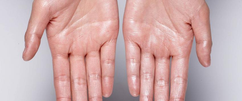 ما الذي يمكن أن يجعلك تتعرقين بسهولة؟ 