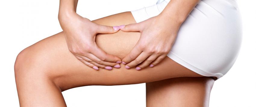 3 علاجات منزلية فعالة للتخلص من "السترتش ماركس".. تعرفي عليها